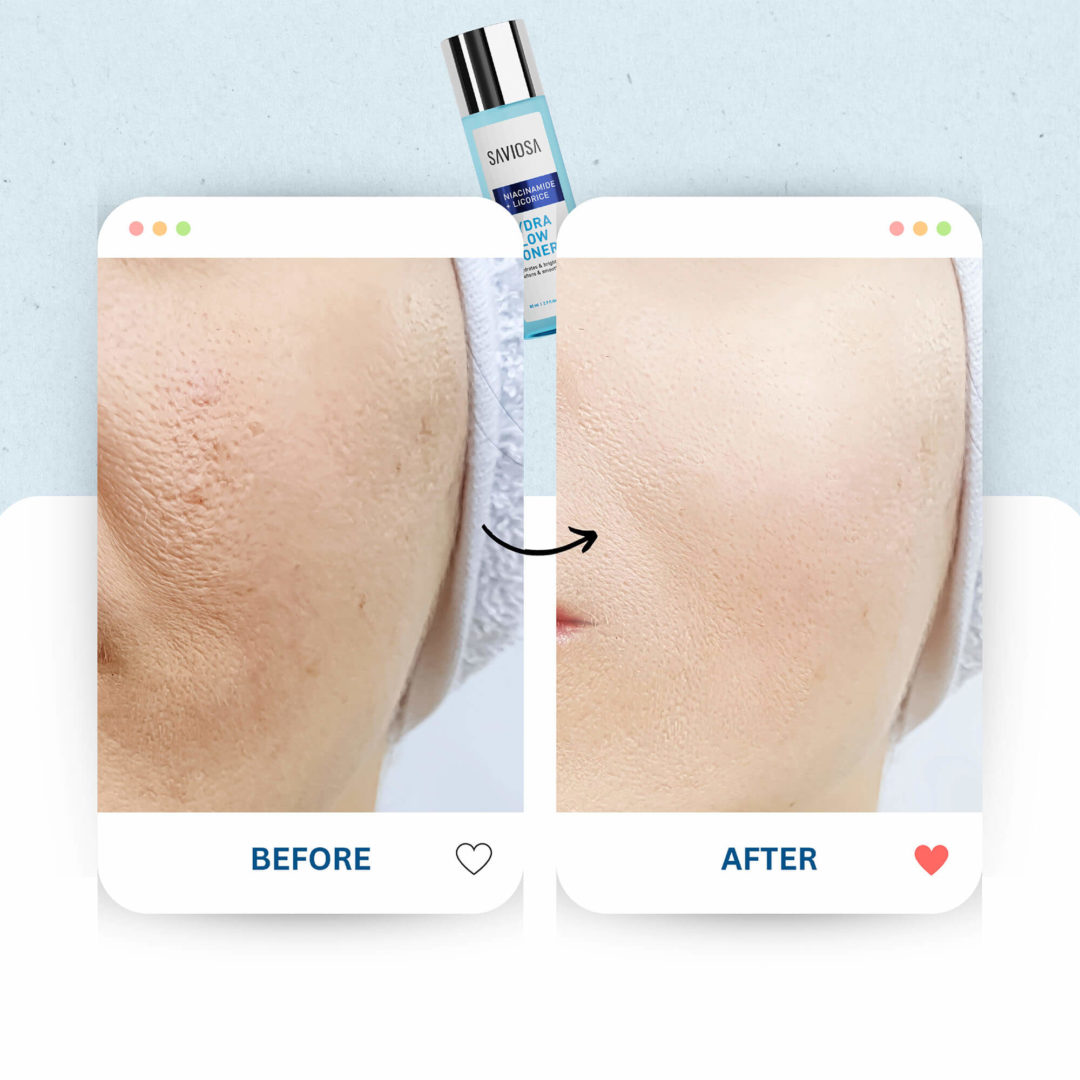 Hydra Glow Toner - Image 4