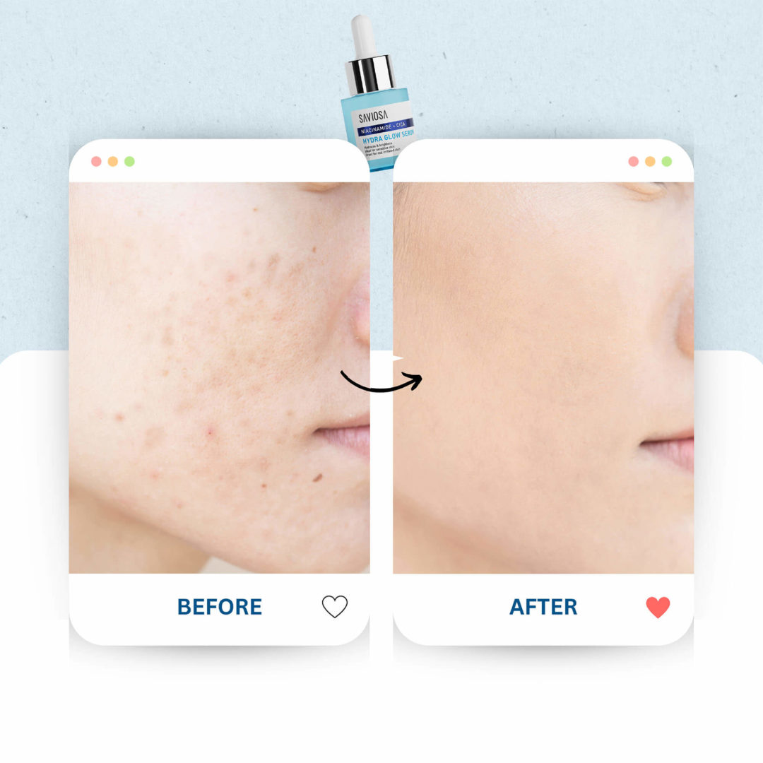 Hydra Glow Serum - Image 7