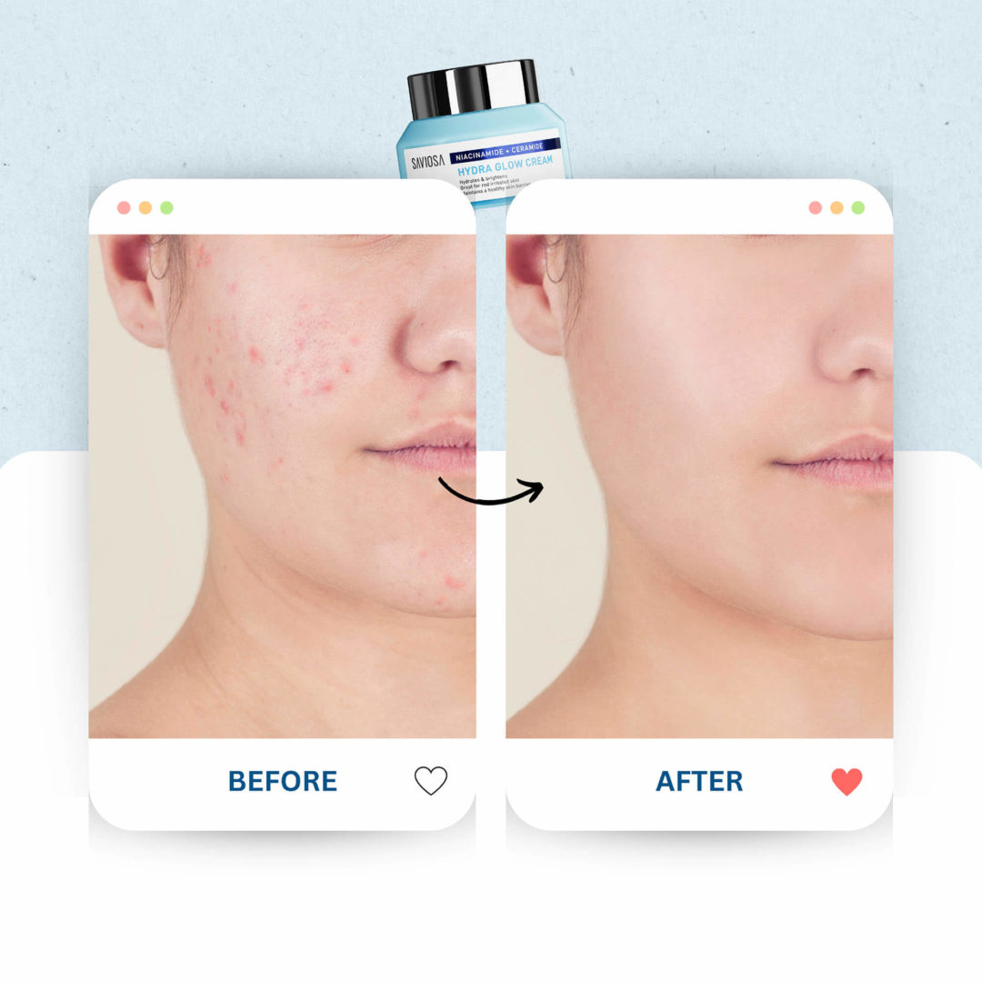 Hydra Glow Cream - Image 7